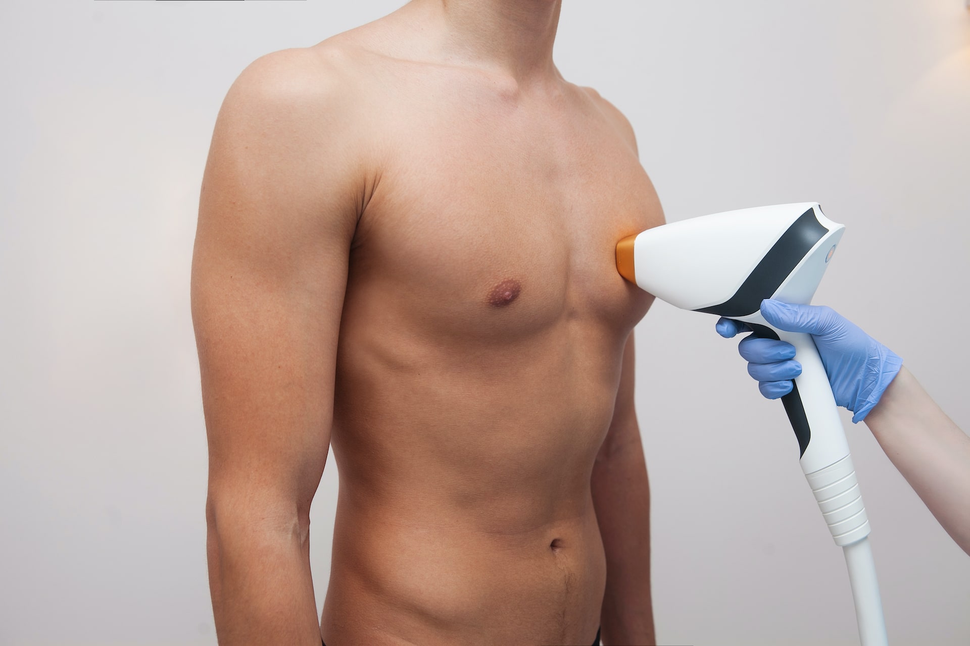 Gynecomastia Treatment (male breast reduction)